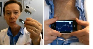 iPhonECG