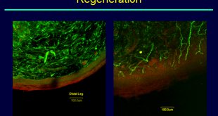 DCMS36_HS_Image