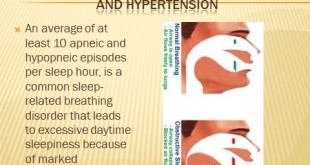 Sleep_Apnea