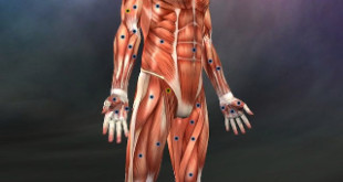 MuscleTrigger1