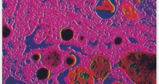 BMJ1