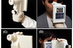 retinacameraimage