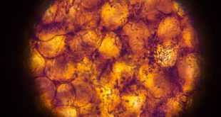 Adipose cell