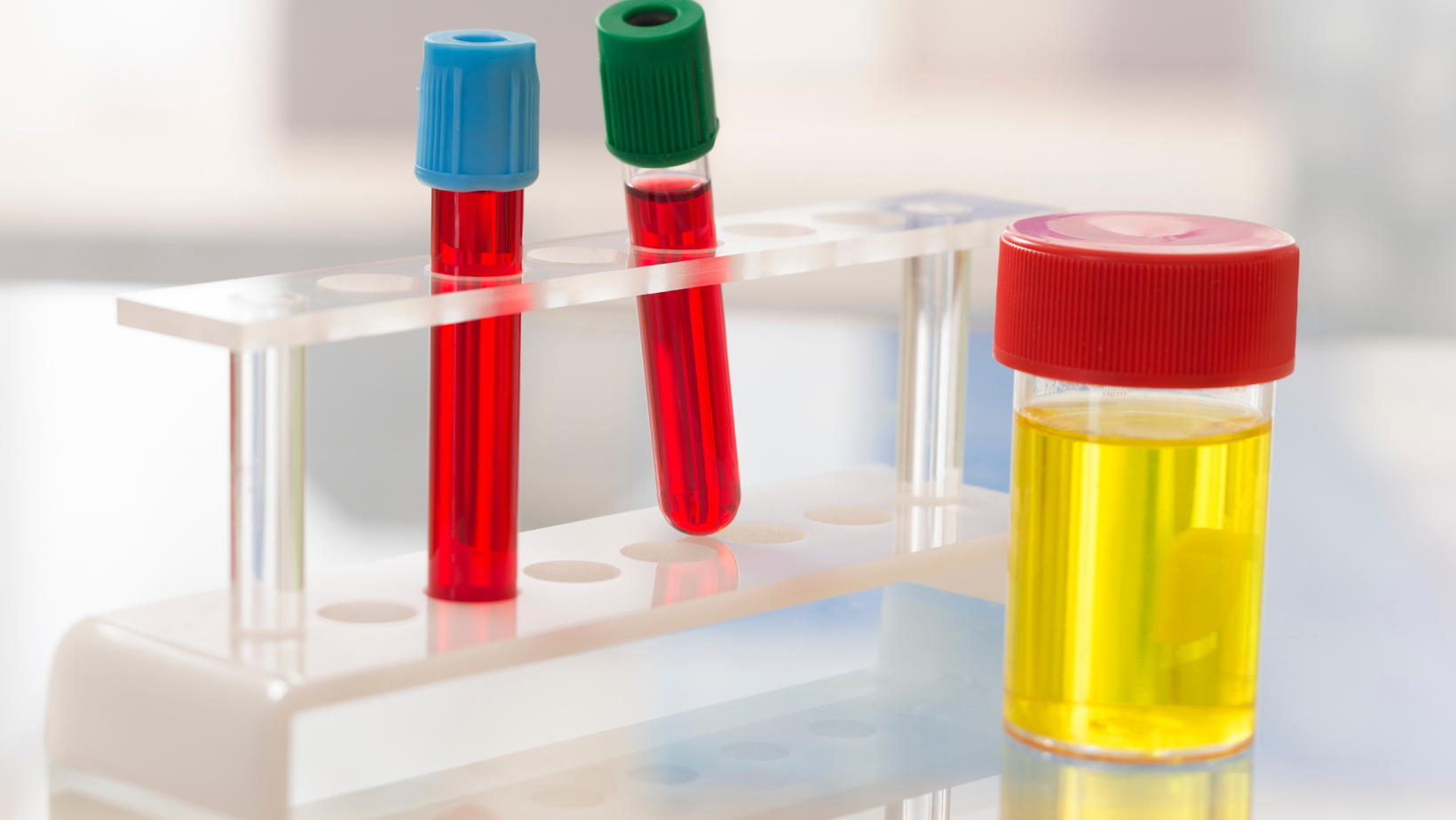 Common and Distinct Genetic Architecture of Age at Diagnosis of Diabetes