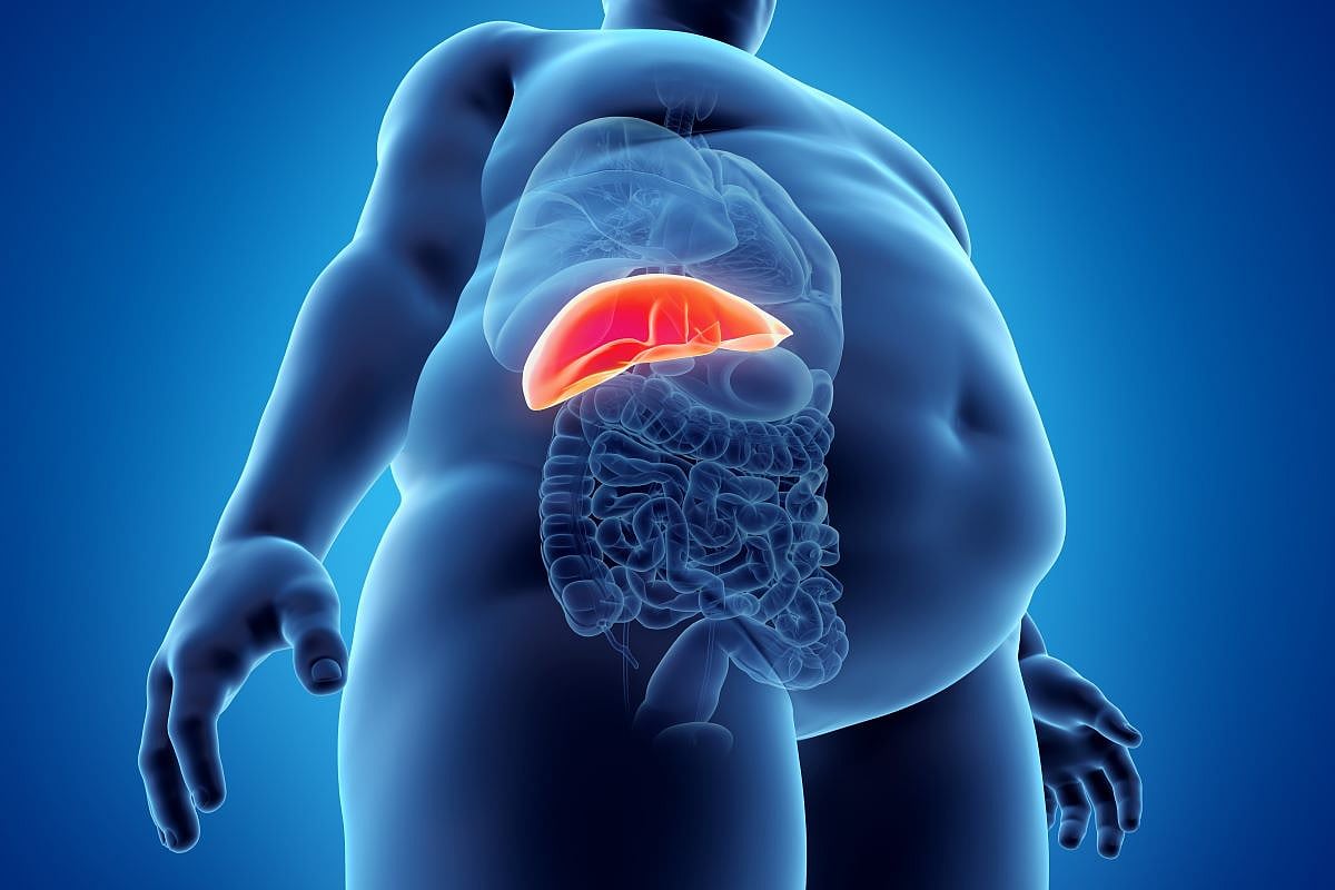 Simultaneous Liver Transplant, Sleeve Gastrectomy Beneficial