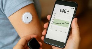 Digital blood sugar monitoring using CGM and mobile device for diabetes control.