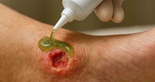 Plant-based gel applied to DFU wound for healing